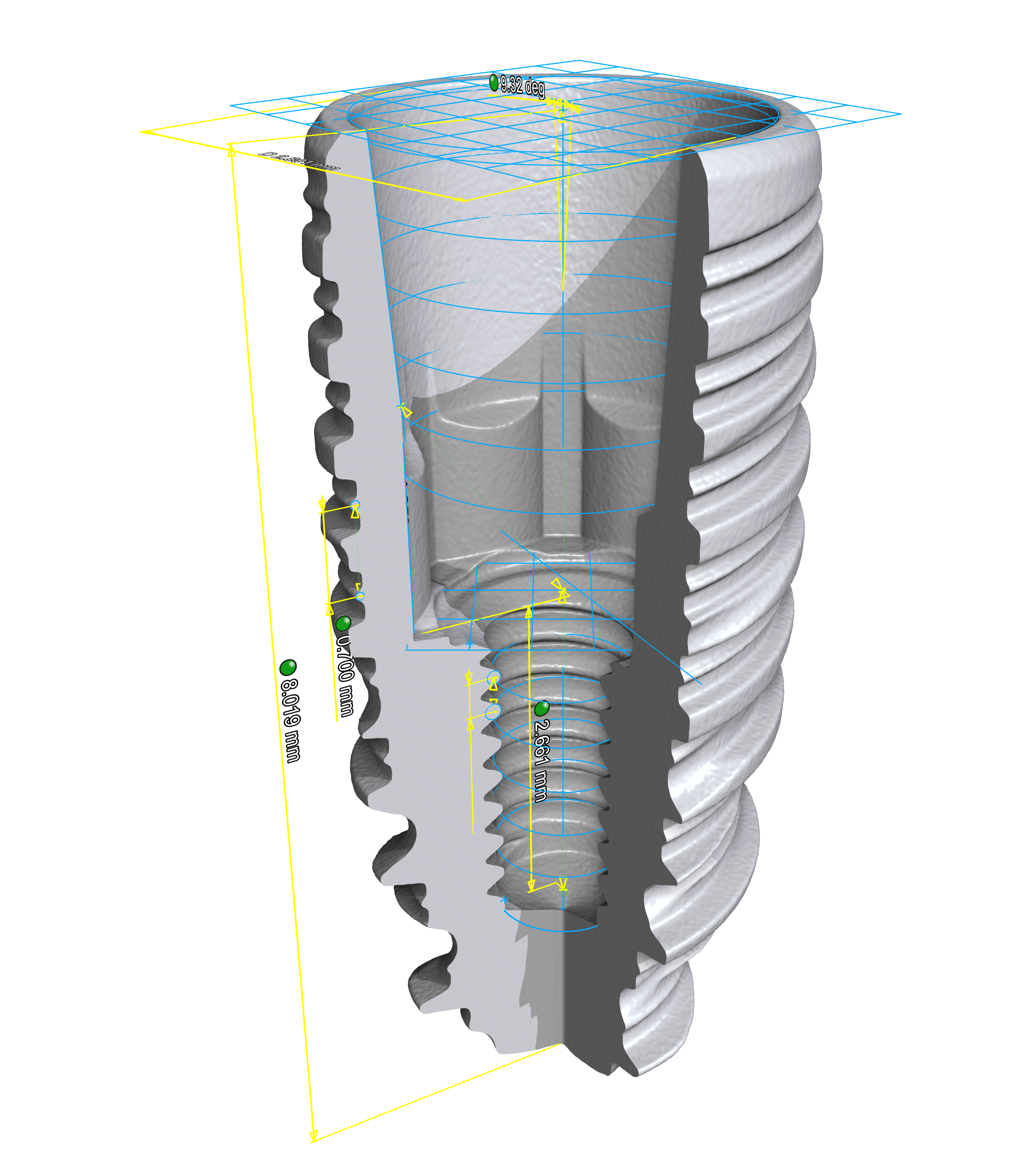 4-Implant_Ti_150kV_47µA_12µm_0,35Cu_SlicesY 2